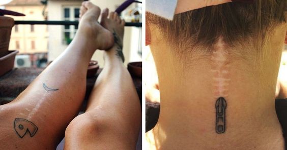 12 tatouages qui transforment les cicatrices en œuvres d'art 10