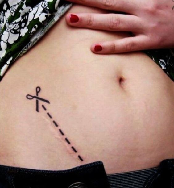 12 tatouages qui transforment les cicatrices en œuvres d'art 1