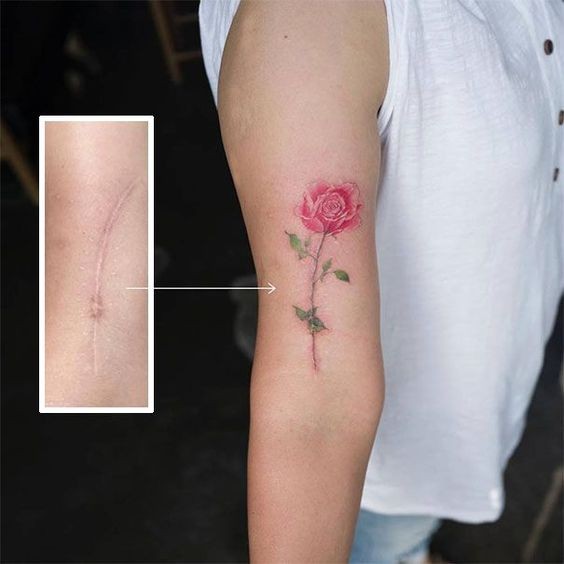 12 tatouages qui transforment les cicatrices en œuvres d'art 4