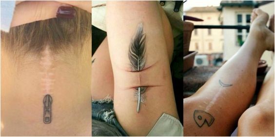 12 tatouages qui transforment les cicatrices en œuvres d'art 6