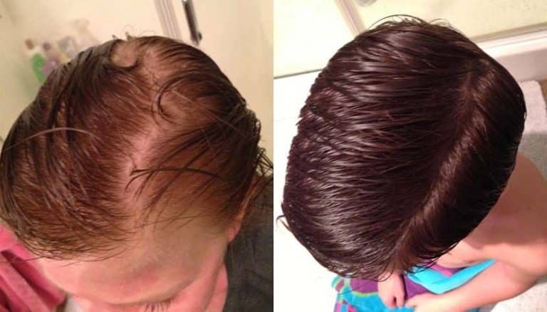 L'huile de Ricin pour les Cheveux: Le Guide Complet