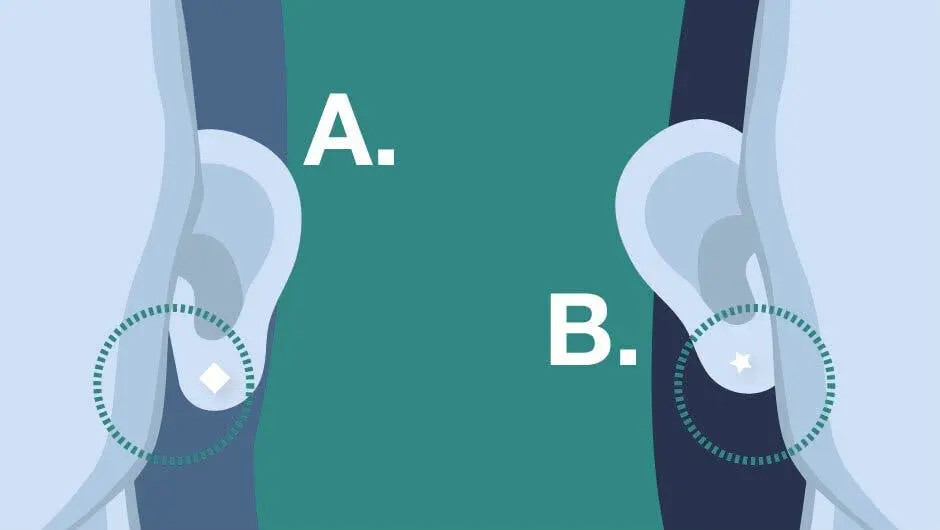 Le lobe de l'oreille attaché ou détaché : Qu'est-ce que cela signifie et d'où vient cette différence génétique ? 1