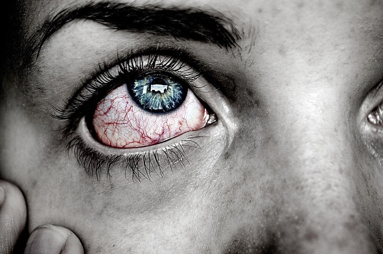 Remèdes de grand-mère yeux qui grattent 2 Remèdes de grand-mère yeux qui grattent 2