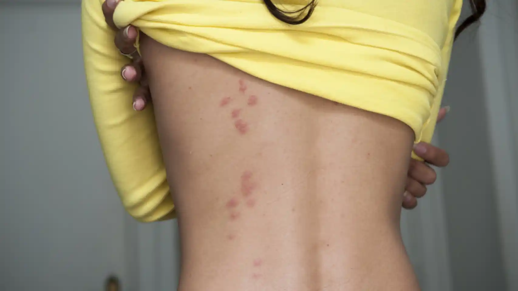 4 Astuces pour se débarrasser définitivement des punaises de lit 5 4 Astuces pour se débarrasser définitivement des punaises de lit 5