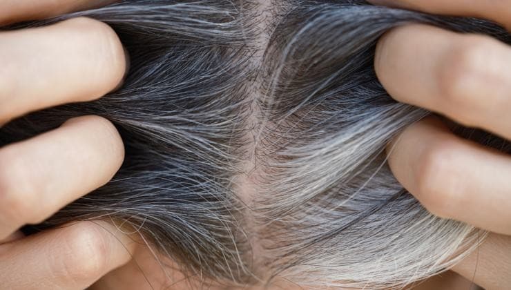 Come prevenire l'ingiallimento dei capelli bianchi 4