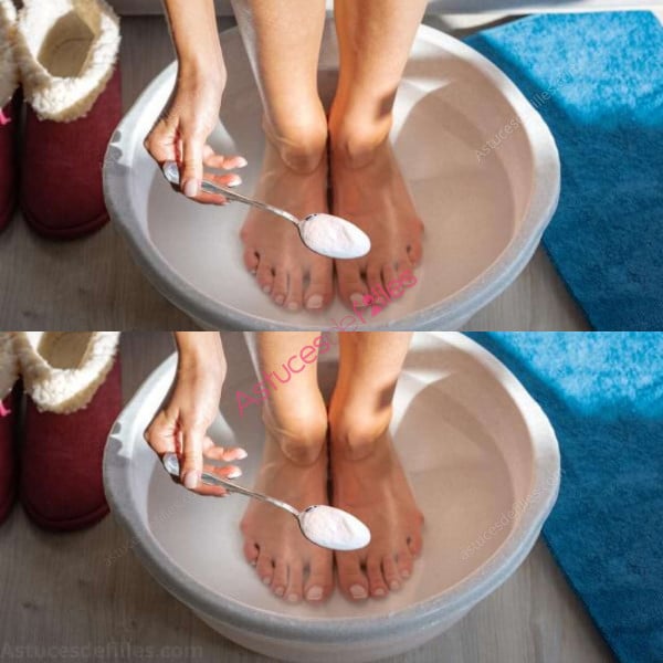 Chevilles Gonflées : 6 Astuces Naturelles Étonnantes ! 4