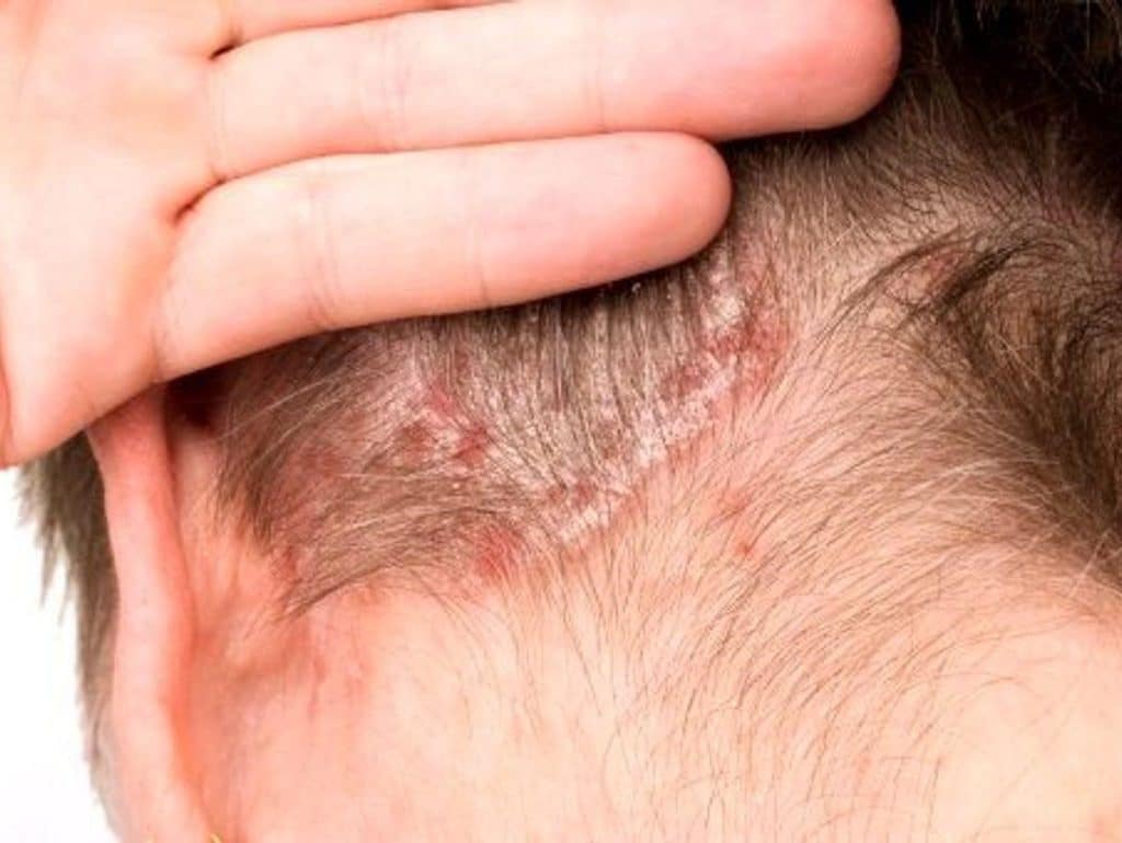 Aloe verra + Cheveux = Danger : Voici pourquoi 3 Aloe verra + Cheveux = Danger : Voici pourquoi 3
