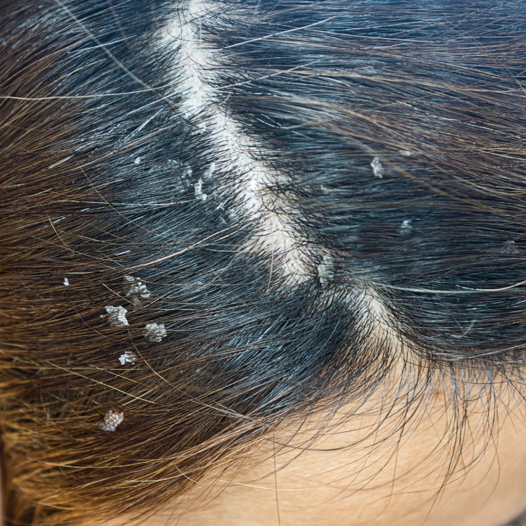 Aloe verra + Cheveux = Danger : Voici pourquoi 4 Aloe verra + Cheveux = Danger : Voici pourquoi 4