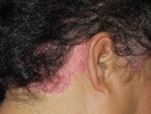 Aloe verra + Cheveux = Danger : Voici pourquoi 5 Aloe verra + Cheveux = Danger : Voici pourquoi 5
