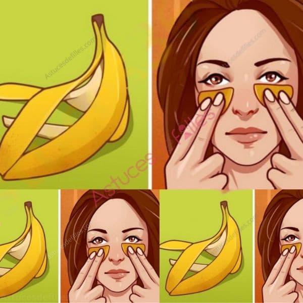 Pelure de Banane - Ne la jetez pas : Voici 7 Utilisations Etonnantes 1 Pelure de Banane - Ne la jetez pas : Voici 7 Utilisations Etonnantes 1