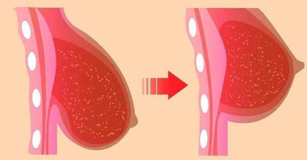 5 astuces pour raffermir votre poitrine tombante 1 5 astuces pour raffermir votre poitrine tombante 1