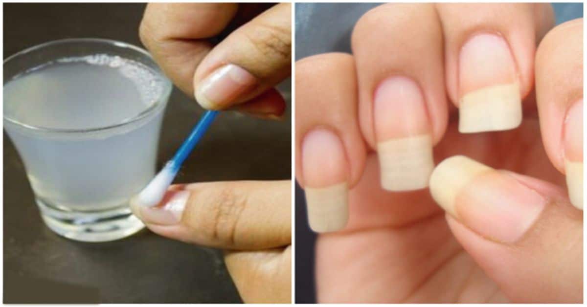 Comment faire pousser ses ongles : 3 astuces de grands-mères 1 Comment faire pousser ses ongles : 3 astuces de grands-mères 1