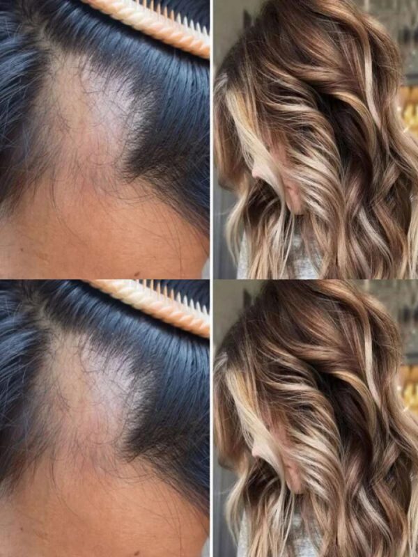 Stratégies de soin capillaire pour contrer la perte de cheveux anormale 1 Stratégies de soin capillaire pour contrer la perte de cheveux anormale 1
