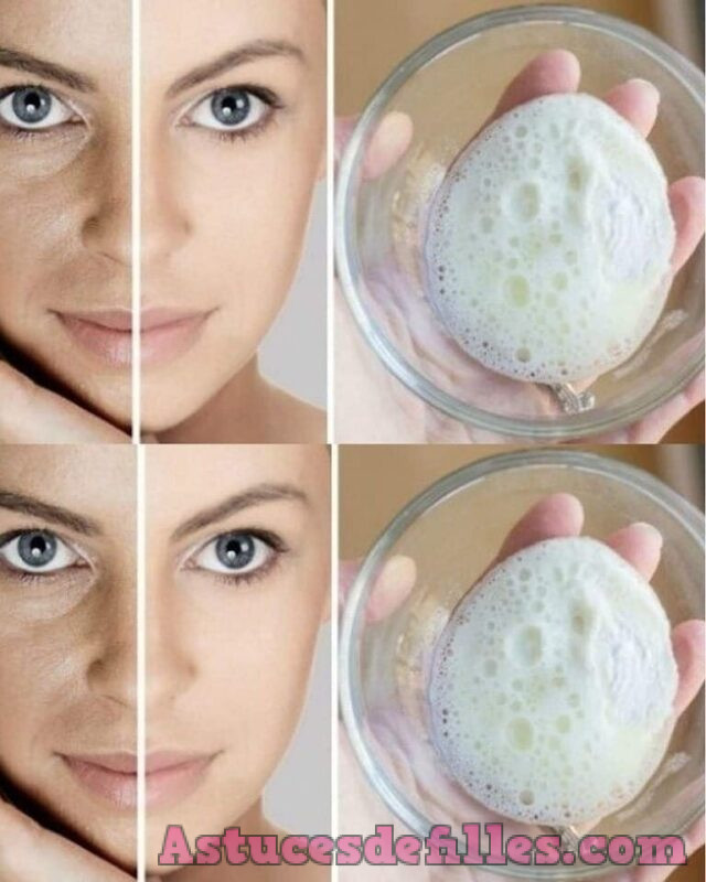 Comment Utiliser le Bicarbonate de Soude pour Enlever les Taches, les Rides et les Cernes du Visage 1 Comment Utiliser le Bicarbonate de Soude pour Enlever les Taches, les Rides et les Cernes du Visage 1